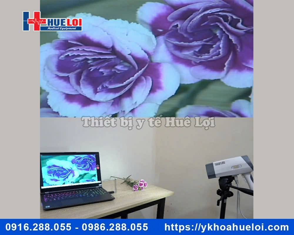 Máy soi cổ tử cung hình ảnh SD