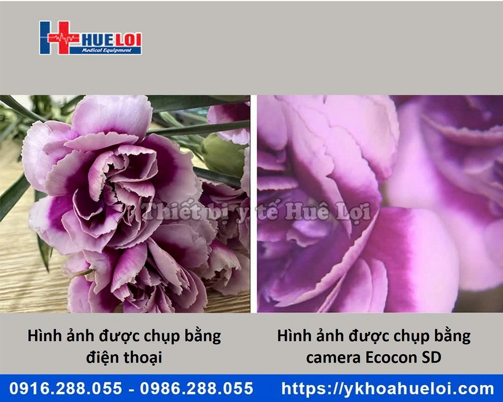 Máy soi cổ tử cung hình ảnh SD