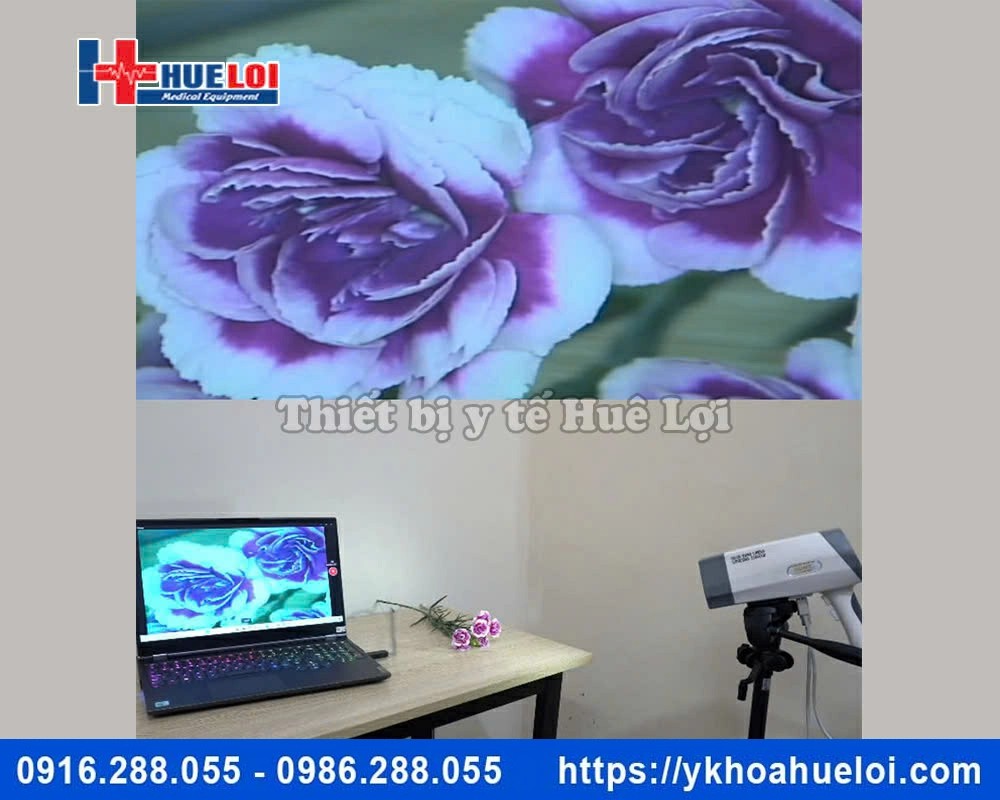 máy soi cổ tử cung Ecocon hình ảnh SD