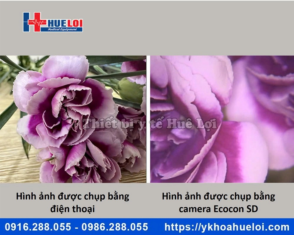 máy soi cổ tử cung Ecocon hình ảnh SD