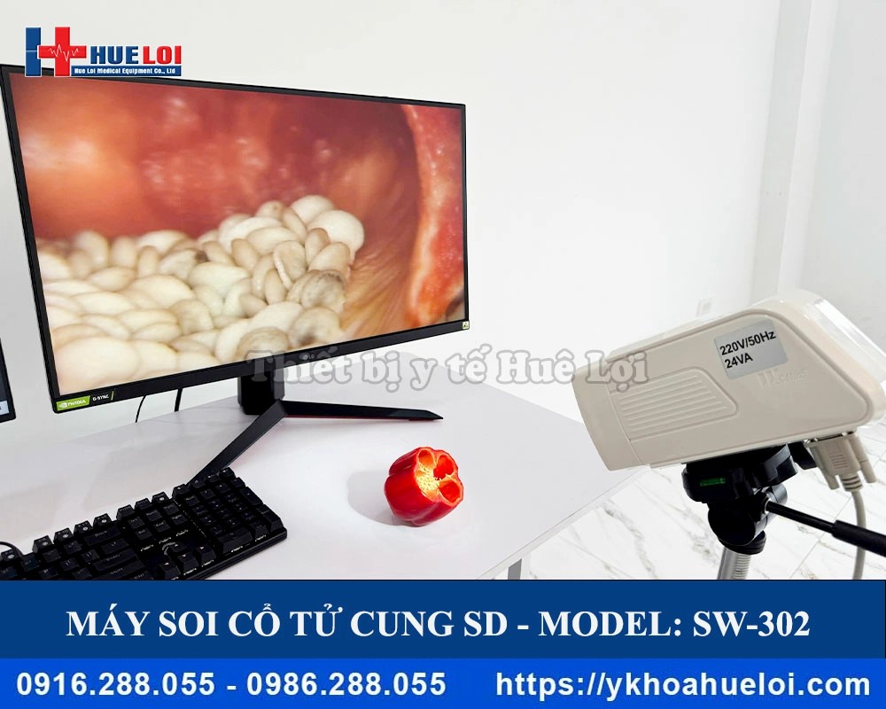 Máy soi cổ tử cung kỹ thuật số SW-3302