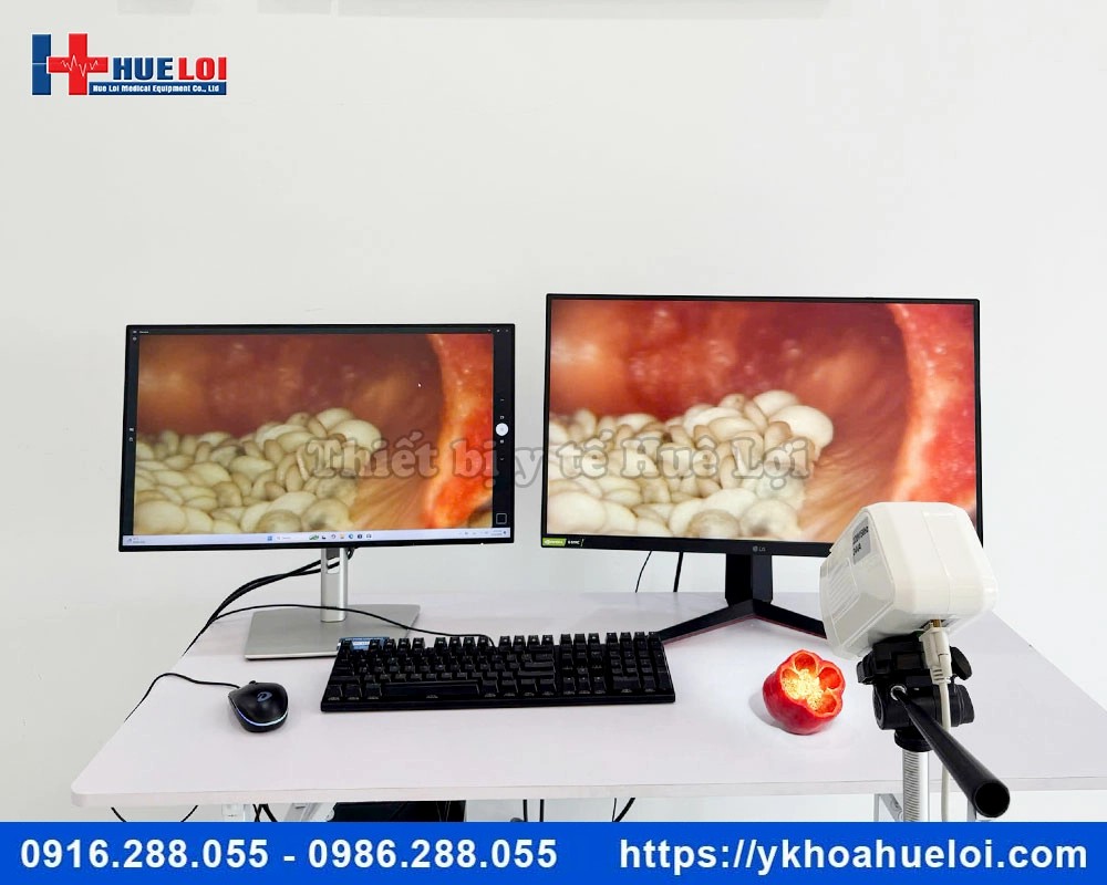 Máy soi cổ tử cung kỹ thuật số SW-3302