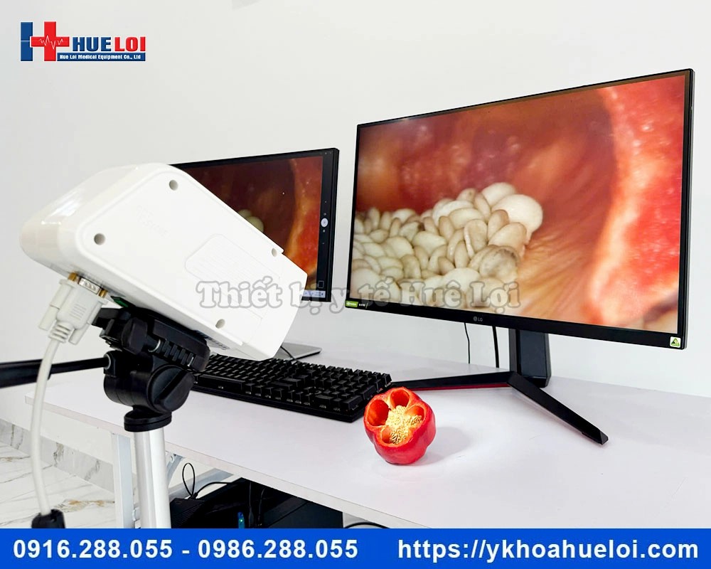 Máy soi cổ tử cung kỹ thuật số SW-3302