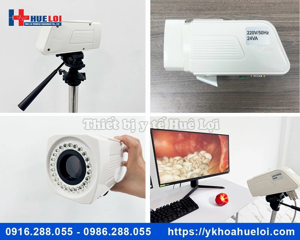 Máy soi cổ tử cung kỹ thuật số SW-3302