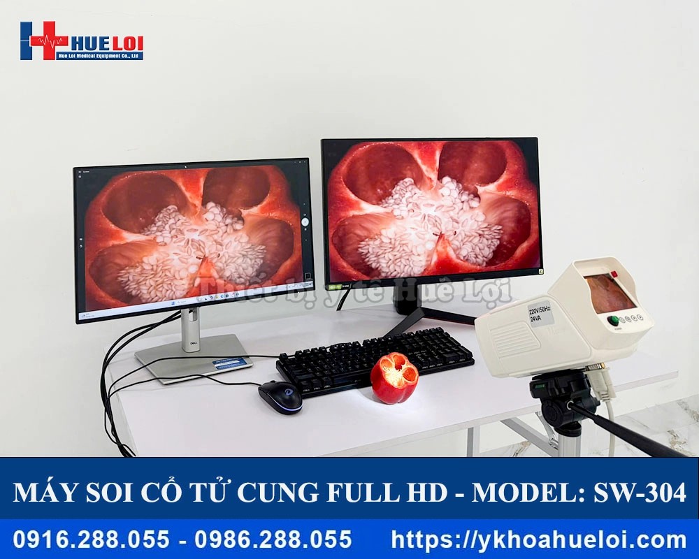 Máy soi cổ tử cung full HD SW-3304
