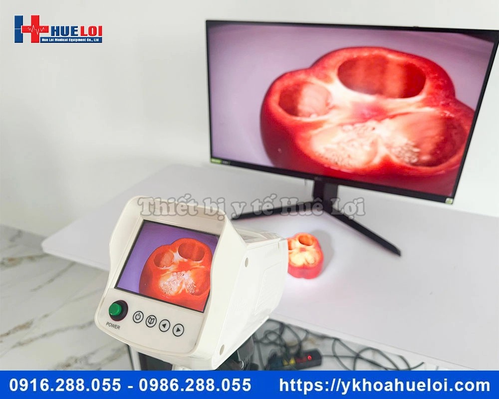 Máy soi cổ tử cung full HD SW-3304