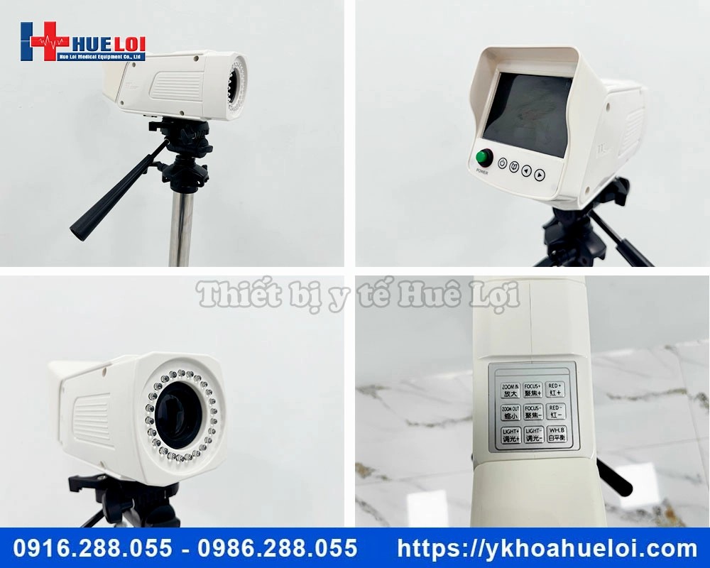 Máy soi cổ tử cung full HD SW-3304