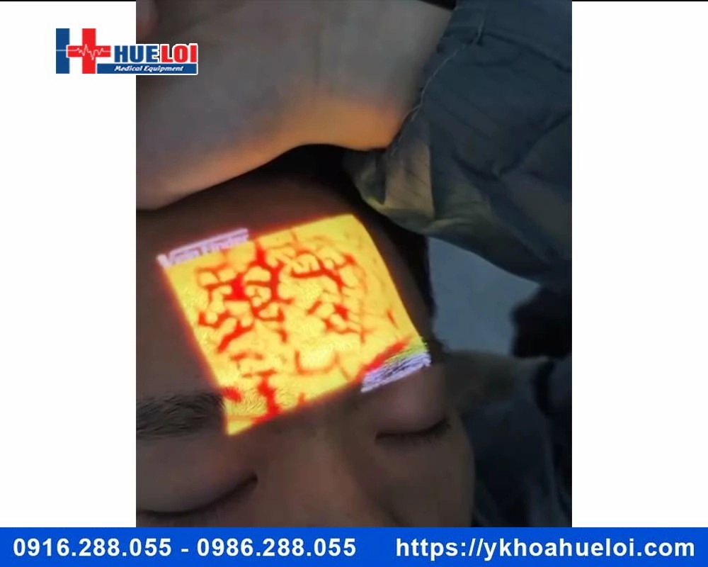 Máy soi tĩnh mạch thế hệ mới QV-600