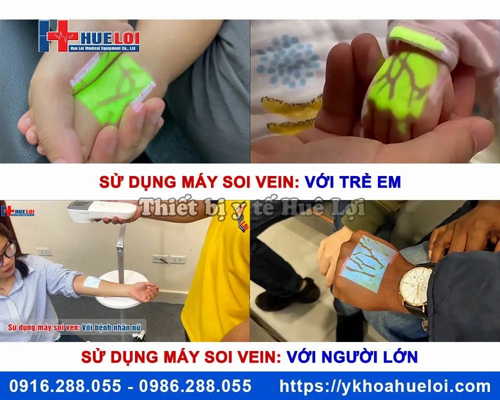 Máy soi tĩnh mạch thế hệ mới QV-600