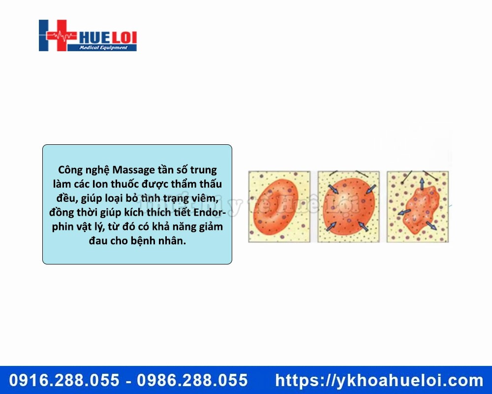 Máy trị liệu bệnh lý tuyến tiền liệt