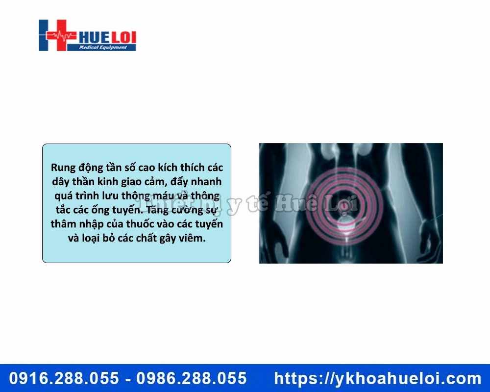 Máy trị liệu bệnh lý tuyến tiền liệt