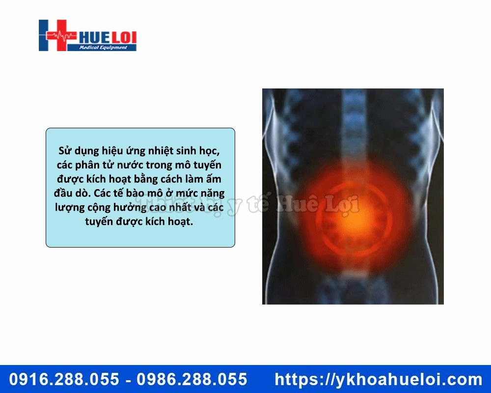 Máy trị liệu bệnh lý tuyến tiền liệt