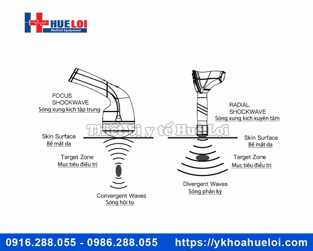 Máy xung kích hội tụ EMFOCUS-1