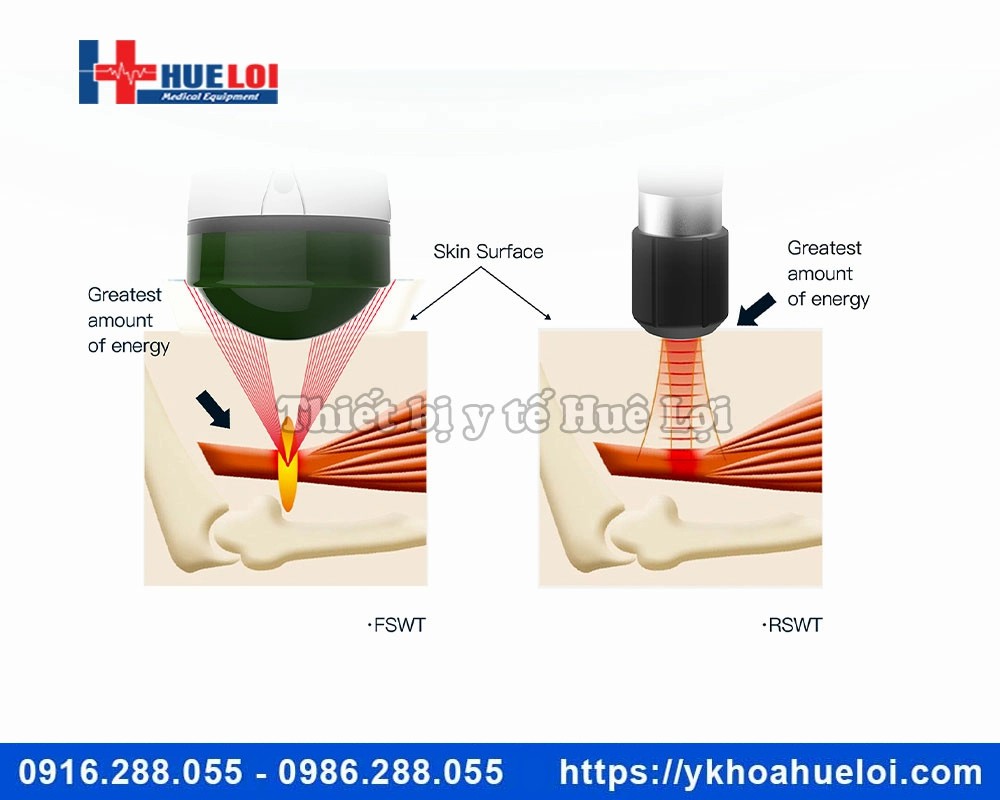 Máy xung kích hội tụ EMFOCUS-1