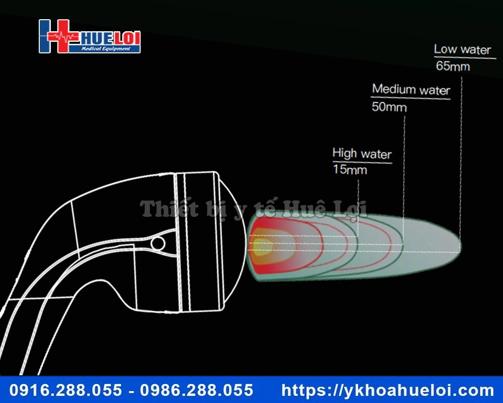 Máy xung kích hội tụ EMFOCUS-I