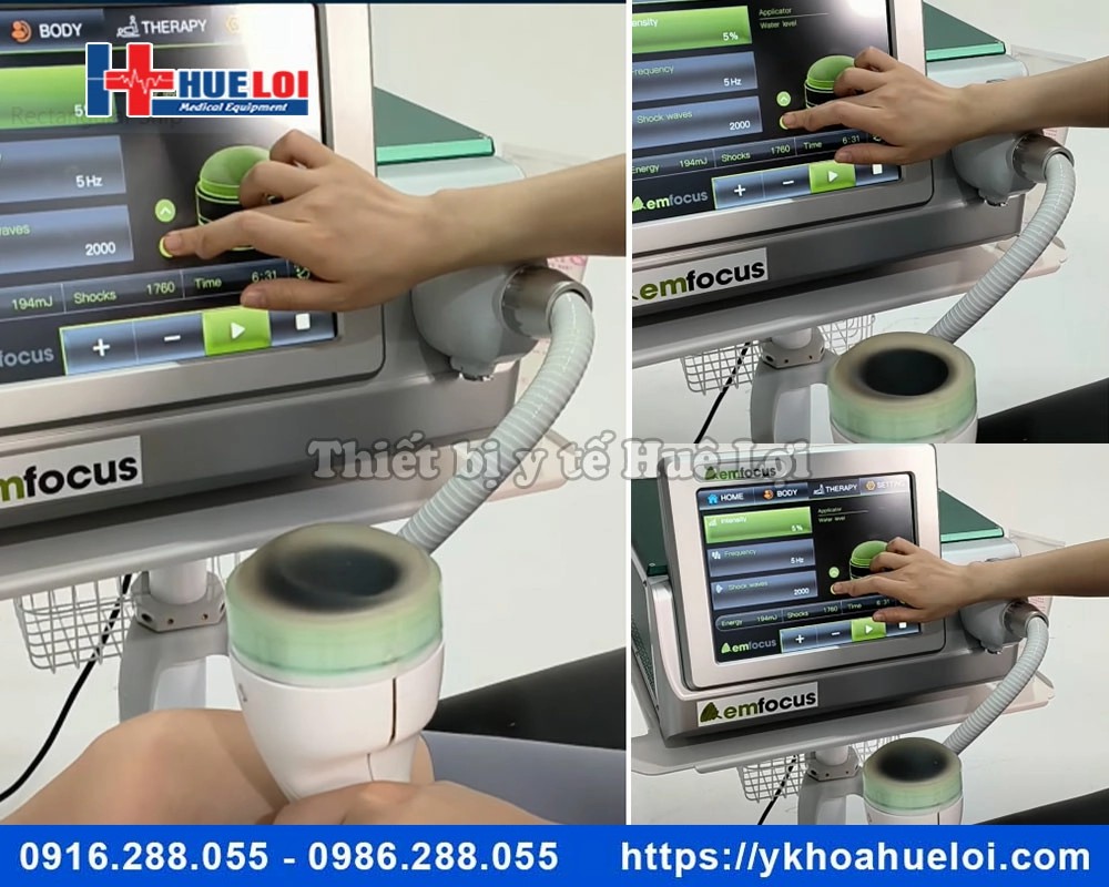 Máy xung kích hội tụ EMFOCUS