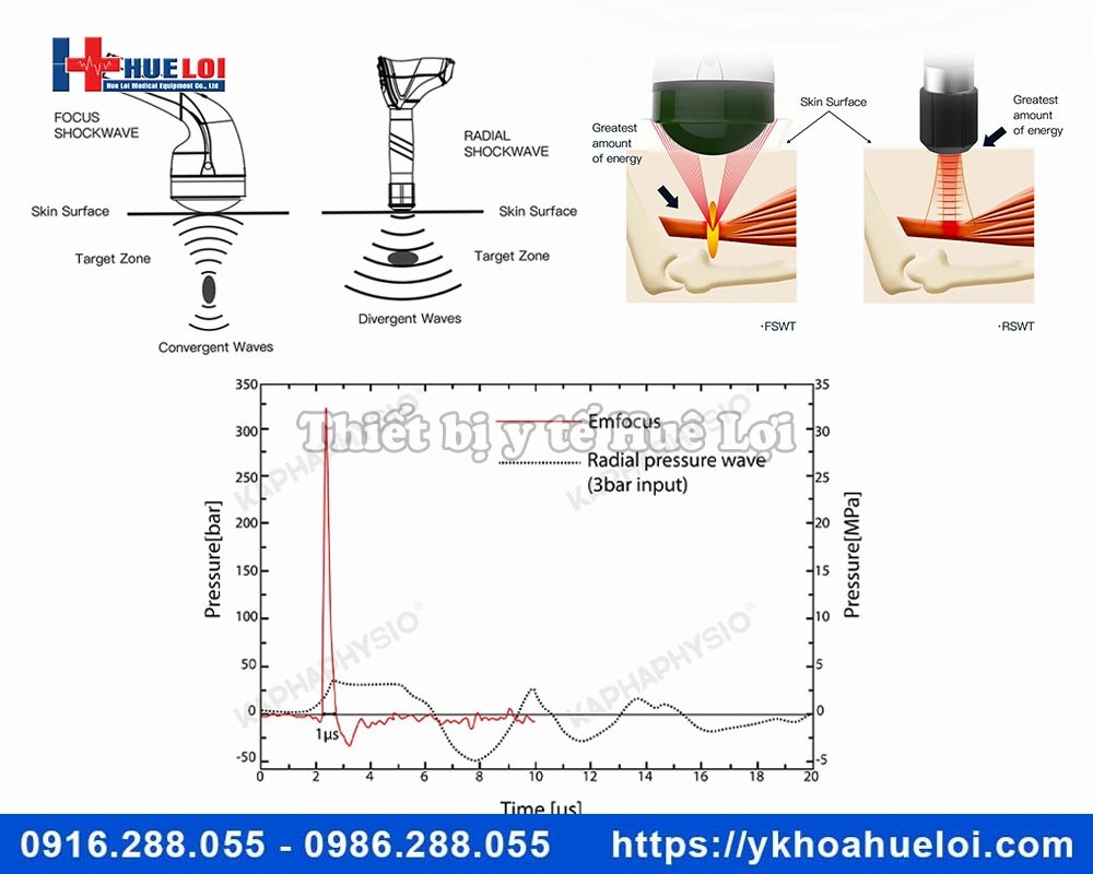 Máy xung kích hội tụ EMFOCUS thế hệ mới