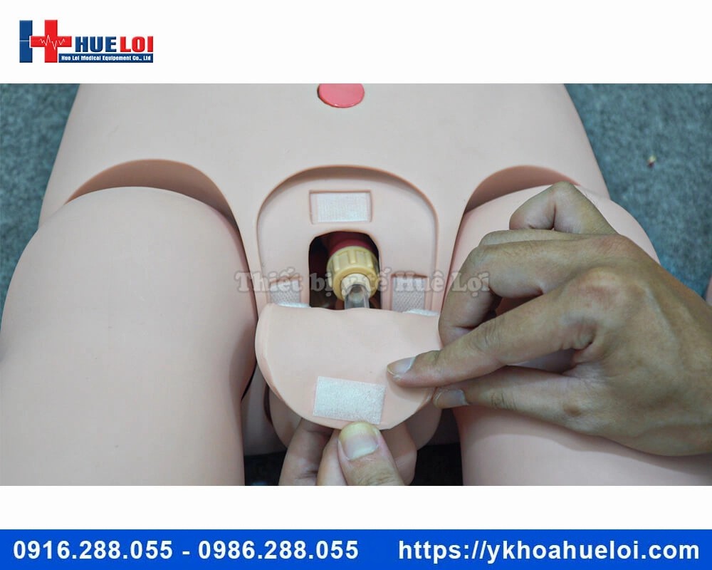 Mô hình chăm sóc điều dưỡng đa chức năng